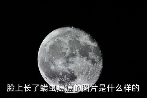 冒痘痘卡通的图片,脸上长痘怎么办?可以试试这些方法